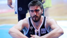 Με αίματα στο πρόσωπο ο Μαργαρίτης, ούτε φάουλ οι διαιτητές!